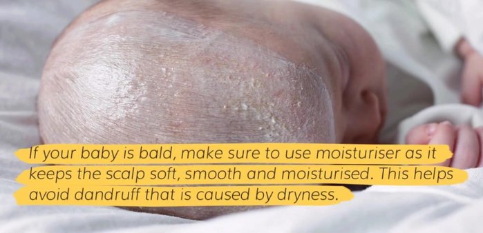 Moisturizing: Use moisturizer on a bald baby's scalp to keep it soft and prevent dandruff.