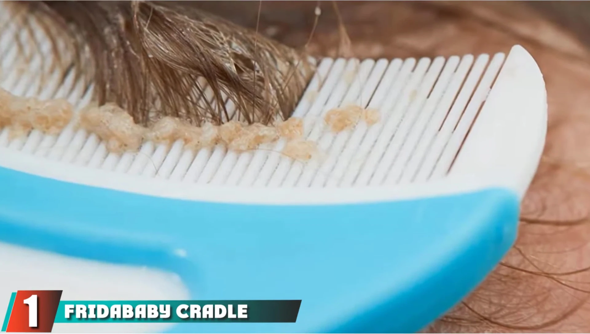 Freo Baby Cradle Cap System product shot