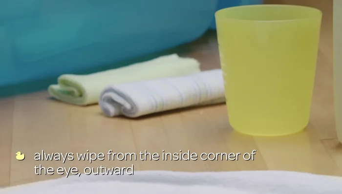 Cleanse your baby's eyes with damp cotton pads and warm water.