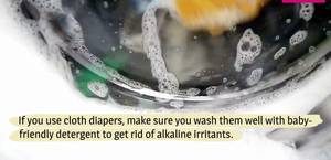 Preventing Diaper Rash: A Complete Guide for Happy Babies
