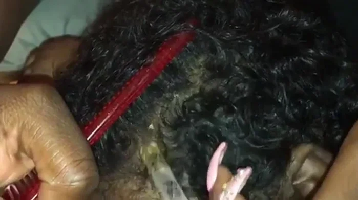 Apply the oil slowly to the scalp, dabbing and rubbing it in with your fingers and a rat-tail comb to distribute evenly.